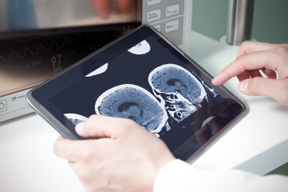 PatientSphere – An AI and Blockchain Based Healthcare Data Sharing Platform