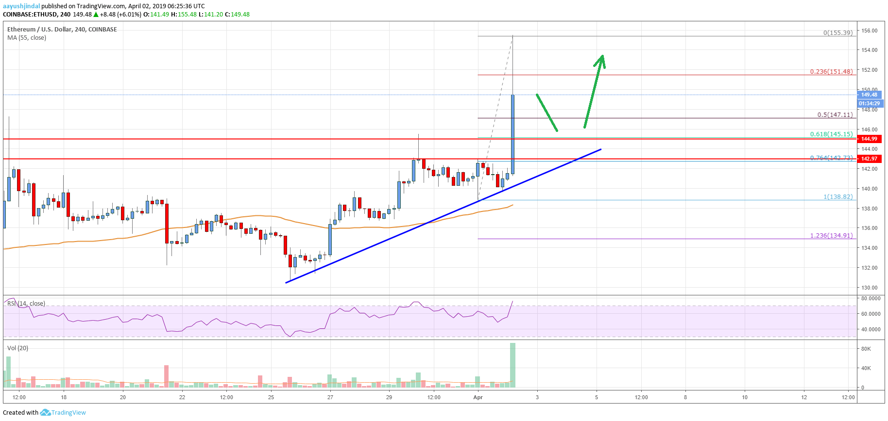 Ethereum Price Analysis: Much Awaited Bullish Break, $160 Next?